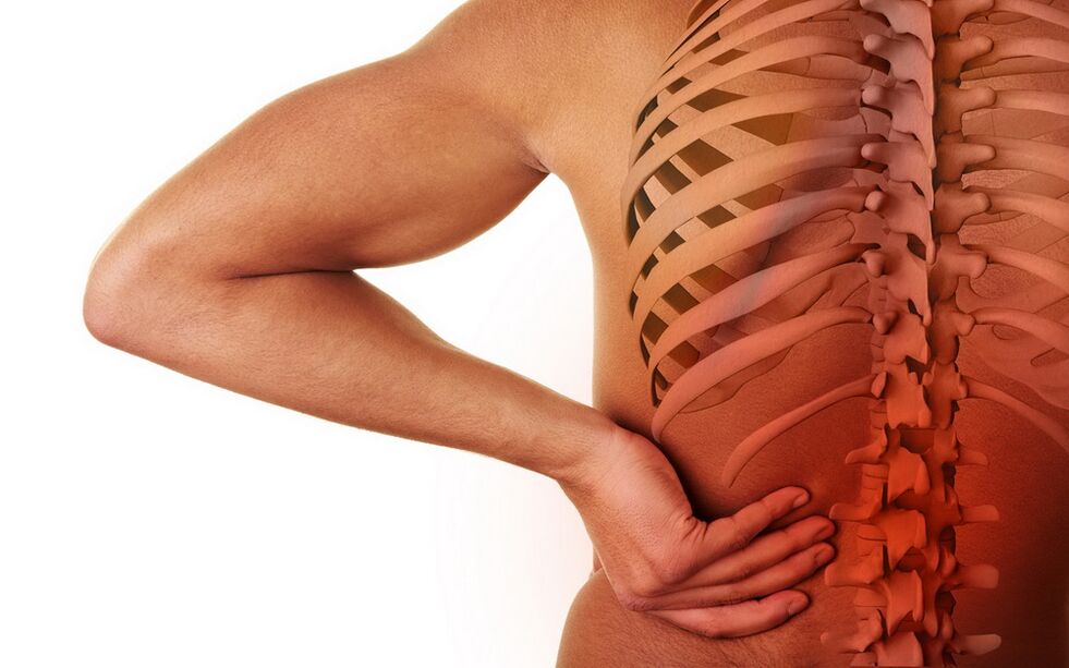 Rückenschmerzen aufgrund von Osteochondrose